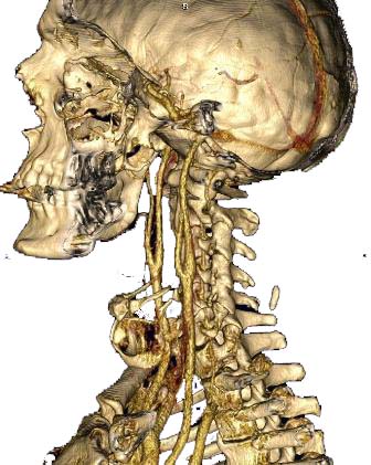el-chequeo-full-body-permite-la-deteccion-precoz-de-cancer-alzheimer-y-enfermedad-cardiovascular-id-87