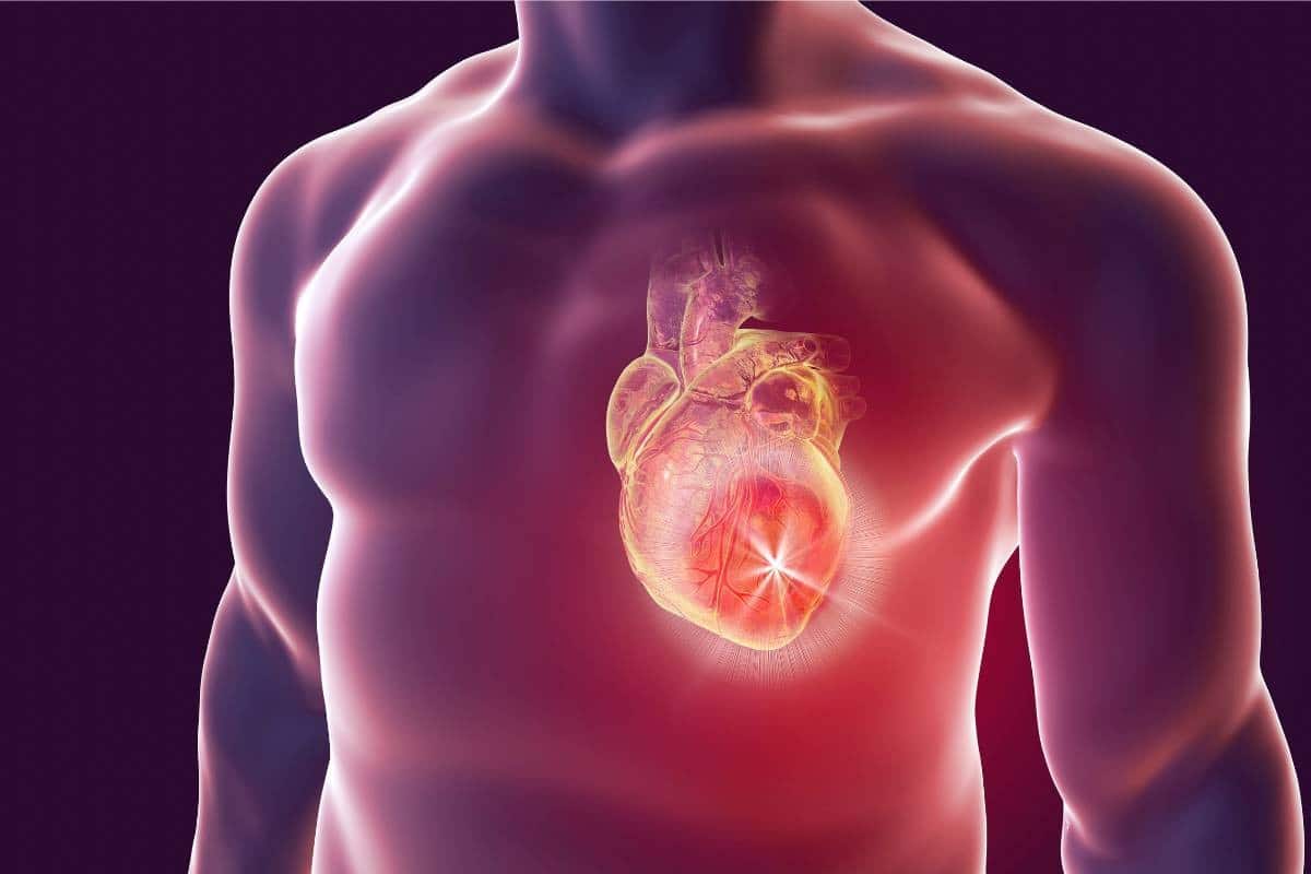 infarto-de-miocardio-que-es-y-que-podemos-hacer-para-prevenirlo-id-77